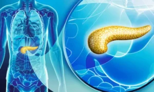 hyperinsulinaemia